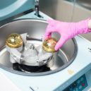 Plazmaterapie ACP - 5_Po roztočení centrifugy se v plazmě obsažené krevní destičky aktivují_foto Klinika GHC Praha_repro zdarma