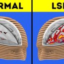 Objev LSD - Jak LSD změní tvůj mozek – YouTube