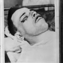 John Dillinger - Mrtvý Dellinger – rána pod pravým okem, kudy vylétla kulka – digitalcommonwealth.org