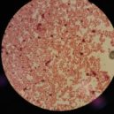 Aggregatibacter - Aggregatibacter 1
