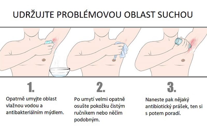 Obrázek #3 z 5