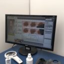 Stan proti melanomu 2019 - Počítač zanalyzoval, že znaménko na chodidle může být rizikové. Lékařka doporučuje kontrolu jednou ročně na kožním.