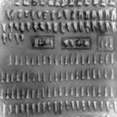 Vrah a kanibal Karl Denke - Denkes Zahnsammlung