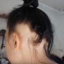 Katka si prošla hrůznou alopecií, dnes je za tuto zkušenost ráda - Káťa, dívka bez korunky