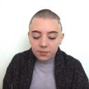 Katka si prošla hrůznou alopecií, dnes je za tuto zkušenost ráda - Káťa, dívka bez korunky