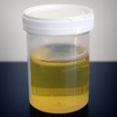 Léčitel Jan Mikolášek - Urine_sample wikimedia sample