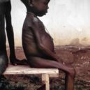 Biafra - Dívka z Biafry trpící podvýživou v důsledku blokády ze strany Nigérie – wikipedie