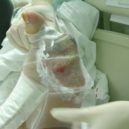 Mrtvou tkáň z ran pacientů požírají larvy. Práce novodobých ranhojiček není snadná - Obrázek2